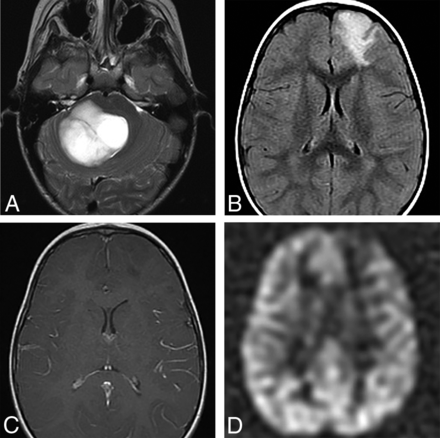 FIG 2.