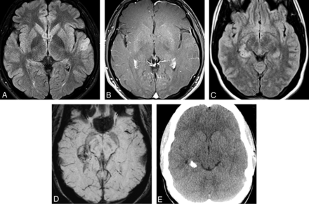 FIG 3.