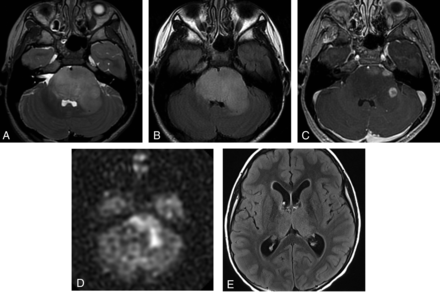 FIG 4.