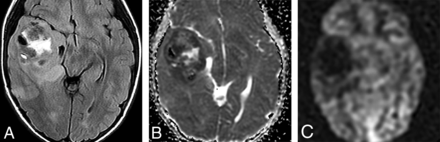 FIG 5.