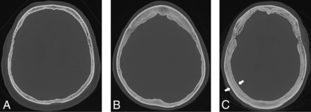 FIG 2.