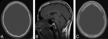 FIG 4.