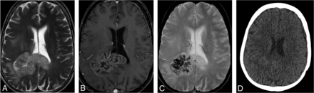 FIG 2.