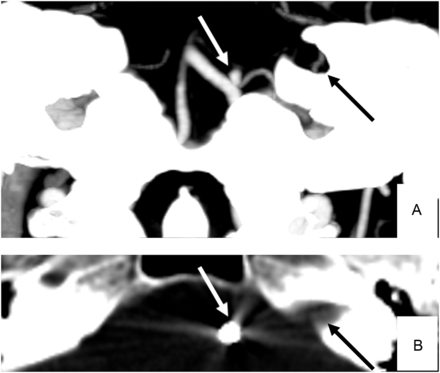 FIG 2.
