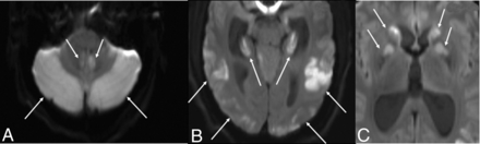 FIG 3.