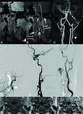 FIG 2.