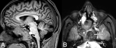 FIG 4.