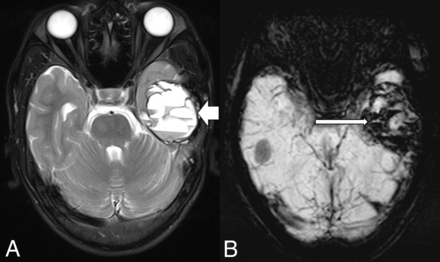 FIG 6.