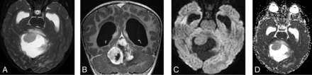 FIG 1.