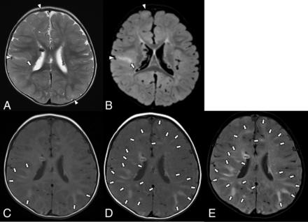 FIG 2.