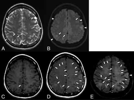 FIG 3.