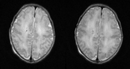FIG 2.