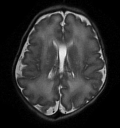 FIG 3.