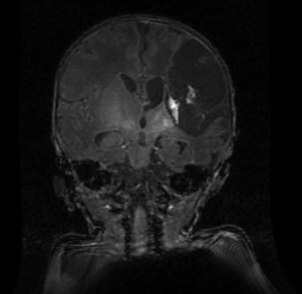 FIG 4.