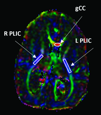 FIG 1.
