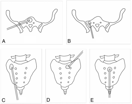 FIG 1.