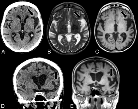 FIG 12.