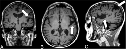 FIG 2.