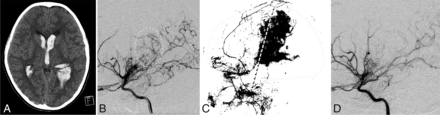 FIG 5.