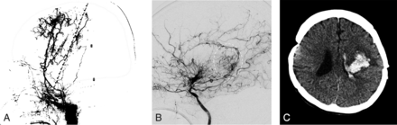 FIG 6.