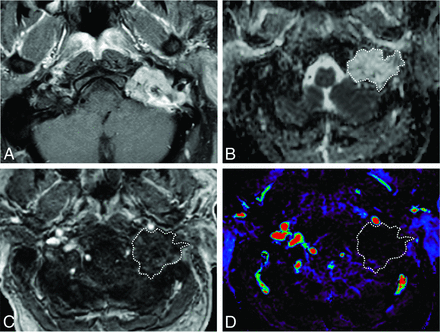 FIG 3.
