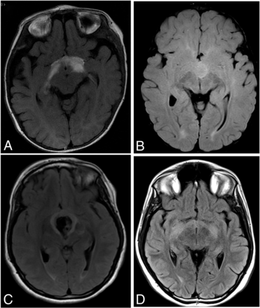 FIG 2.