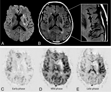 FIG 1.
