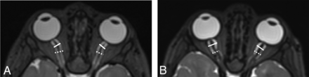 FIG 1.