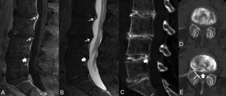 FIG 3.