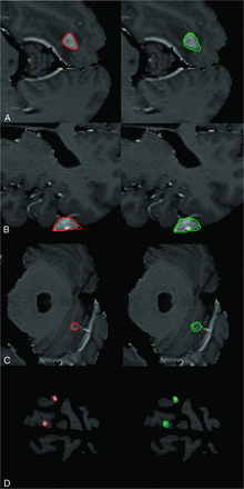 FIG 2.