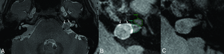 FIG 2.