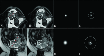 FIG 3.
