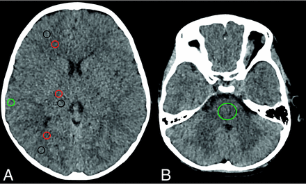 FIG 1.