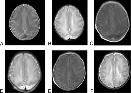 FIG 3.