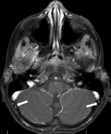 FIG 2.