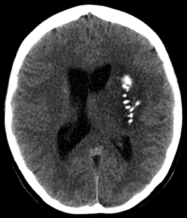 FIG 2.