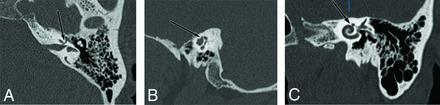 FIG 2.