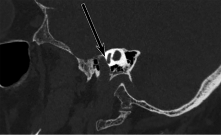 FIG 4.