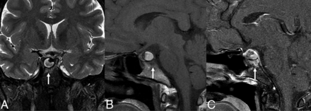 FIG 3.