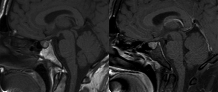 FIG 4.