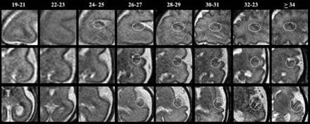 FIG 6.