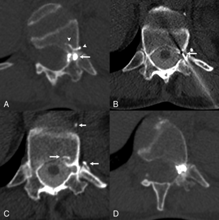 FIG 2.