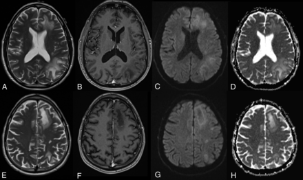 FIG 3.