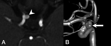 Fig 1.