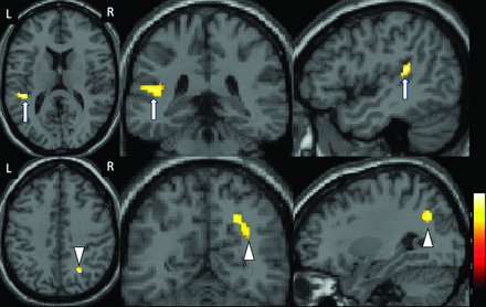 FIG 1.