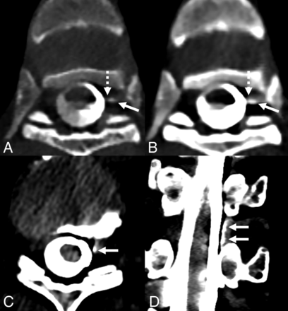 FIG 3.