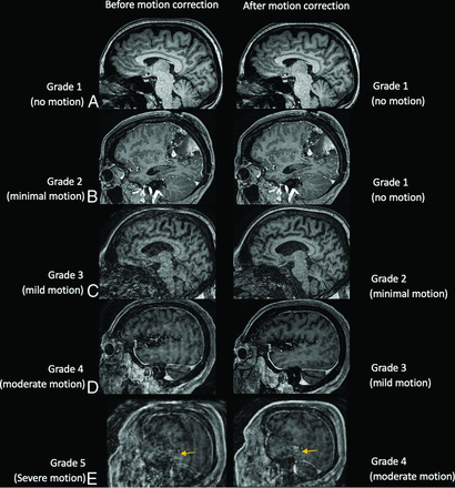 FIG 2.