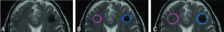 FIG 2.