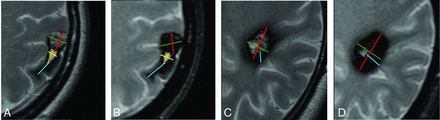 FIG 3.