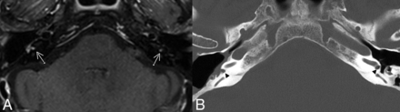 FIG 1.